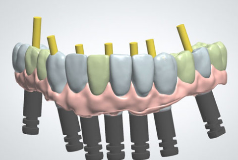 Dental Lab